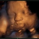 Inseminazione Intrauterina: procedura e indicazioni
